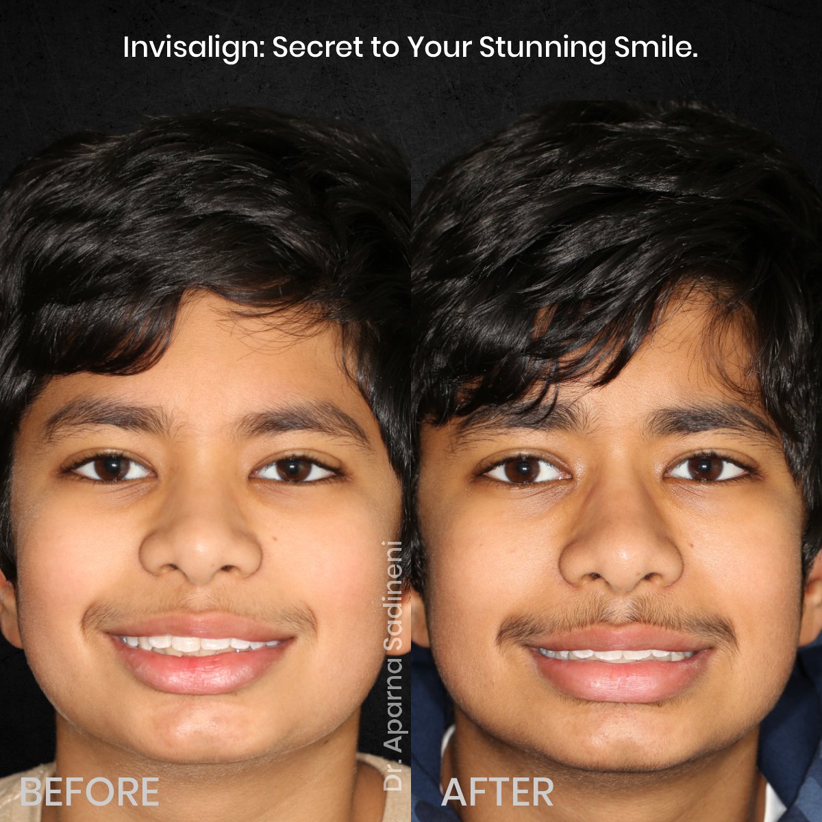 DMD-NOV-GRID-3-POST-5-HEADSHOT-B_A-ARUSH_1-1