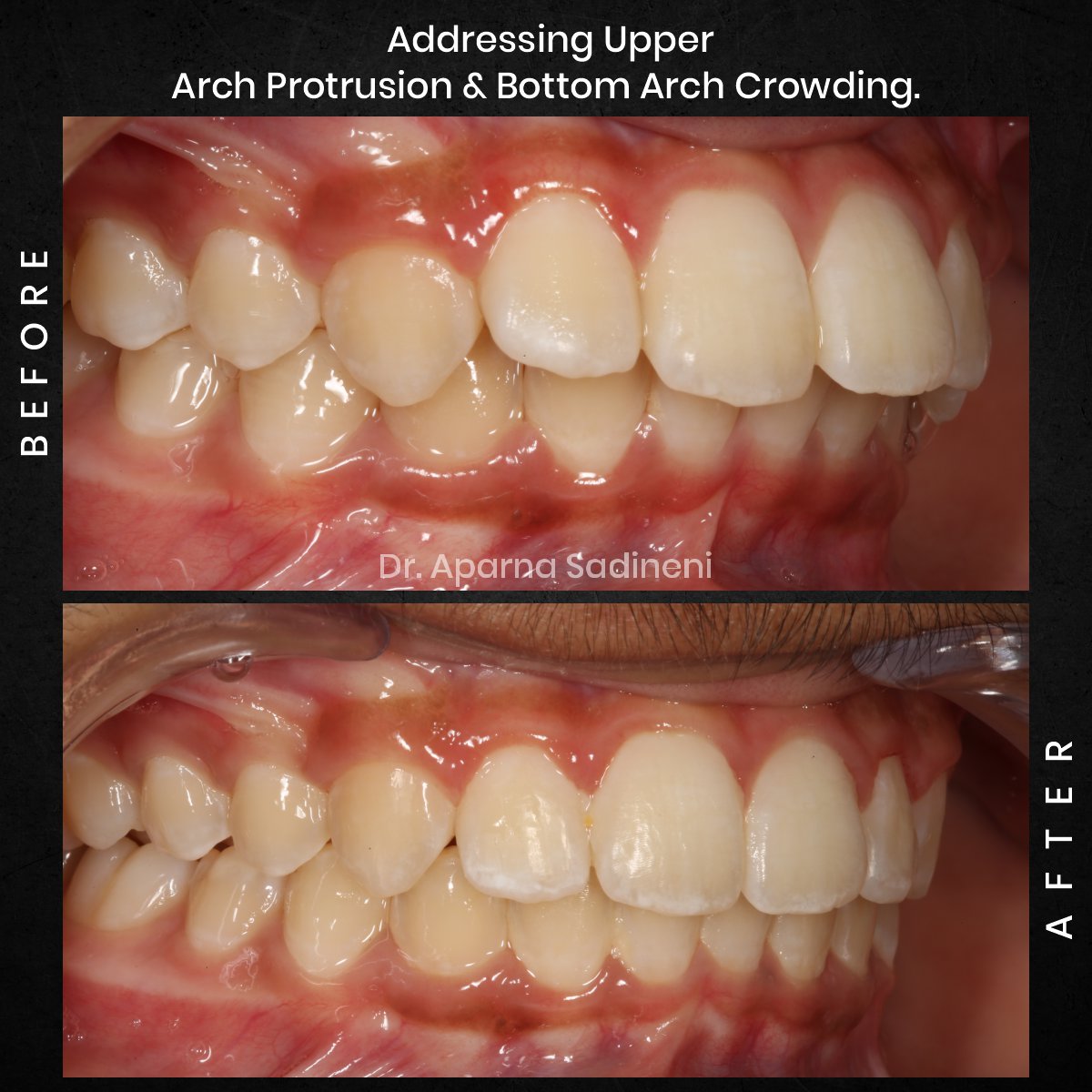 DMD-NOV-GRID-3-POST-5-HEADSHOT-B_A-ARUSH_2-1