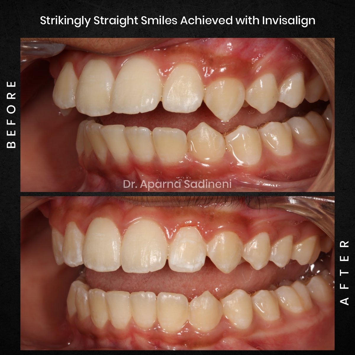 DMD-NOV-GRID-3-POST-5-HEADSHOT-B_A-ARUSH_4-1