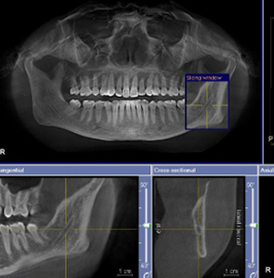 3D Imaging Technology