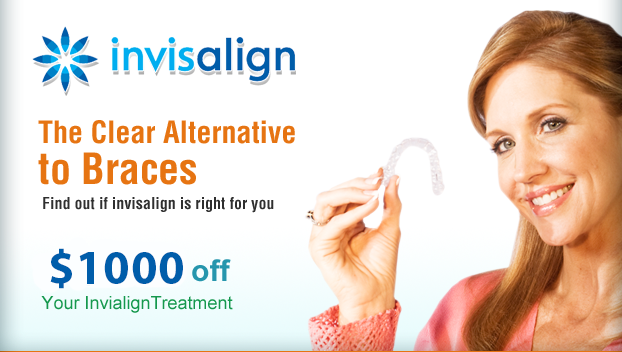 Invisalign Clear Braces Offer