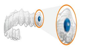 Invisalign Teen aligners